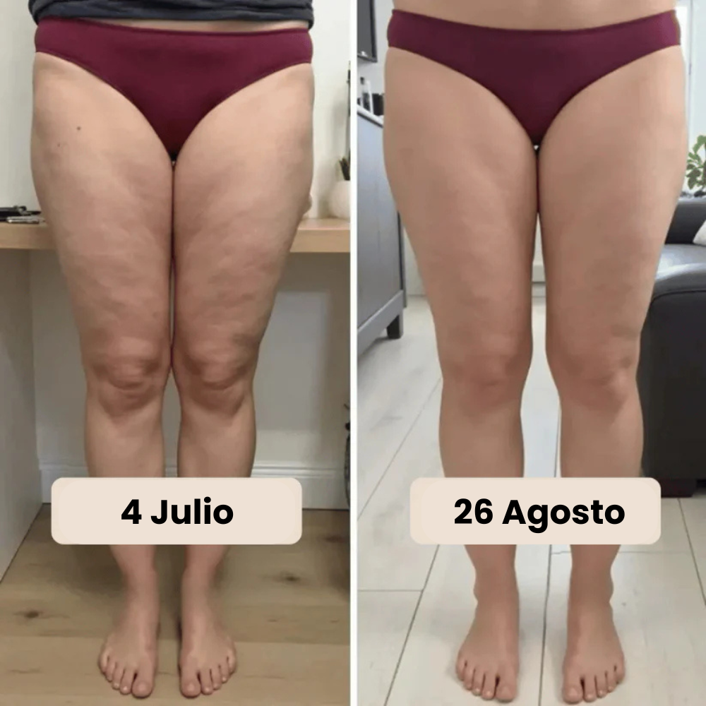 Leggings 3D Anticelulíticos