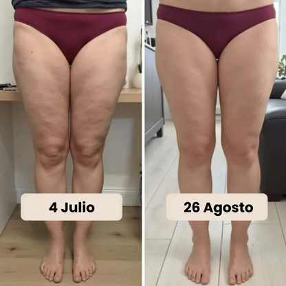 Leggings 3D Anticelulíticos
